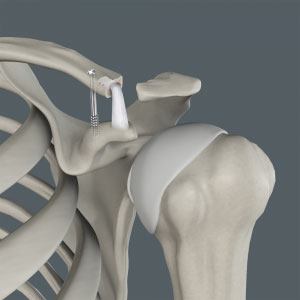 knee-anatomy
