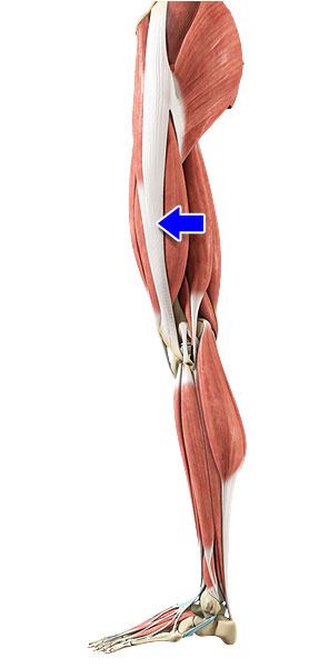 Iliotibial Band Syndrome Everett, Knee Pain Lake Stevens