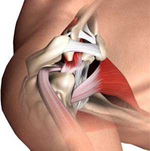 subacromial-decompression